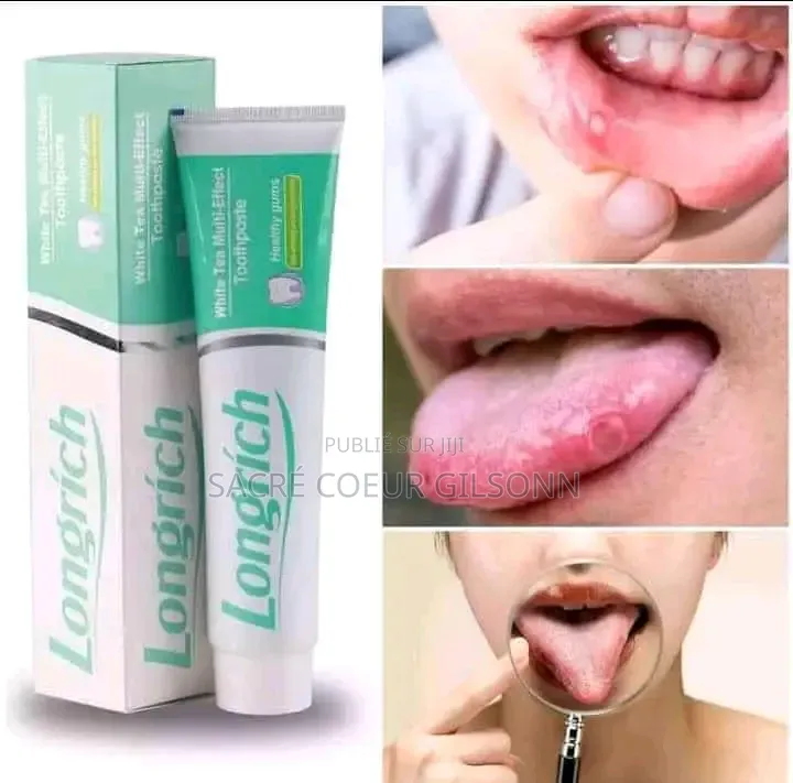 Pâte Dentifrice
