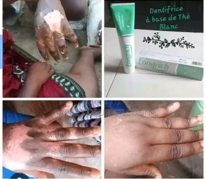 Pâte Dentifrice