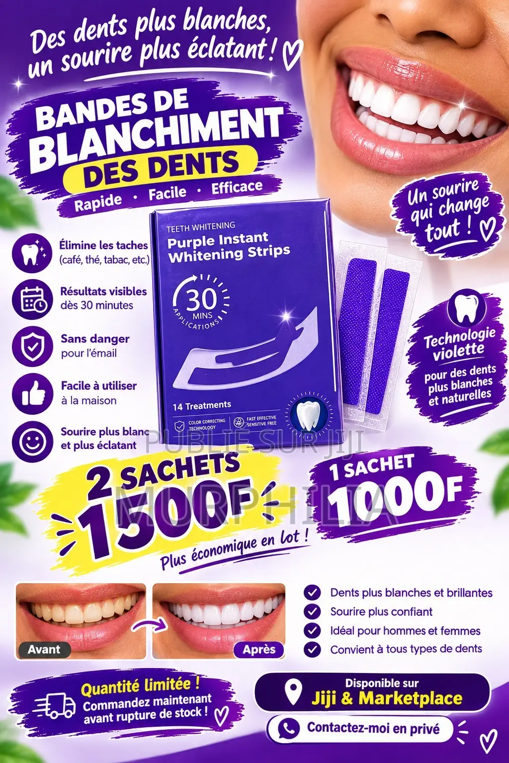  Bandes De Blanchiment Des Dents – 2 Sachets À 1 500f 