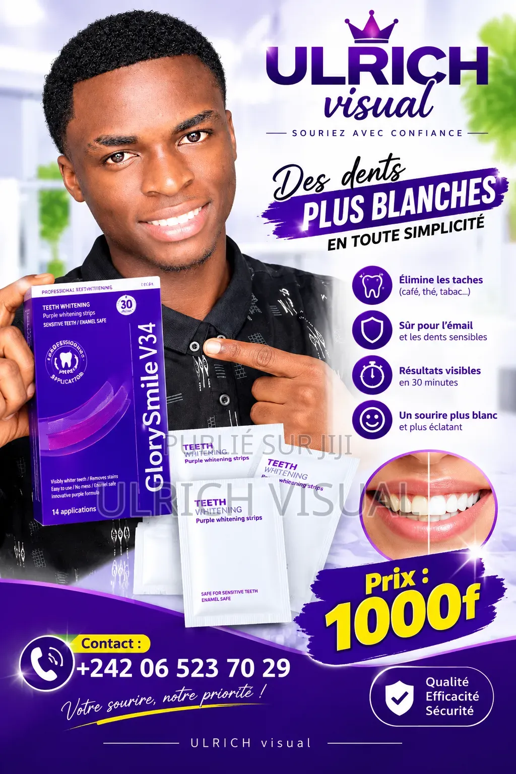 Blanchiment 
