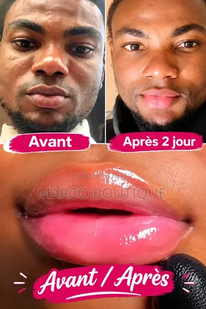 Baume À Lèvres Rose
