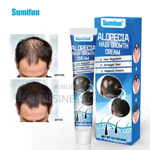 Crème Crowth Pour Cheveux À L’Alopécie