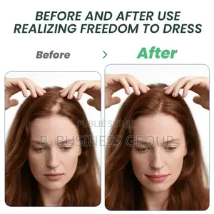 Crème Crowth Pour Cheveux À L’Alopécie