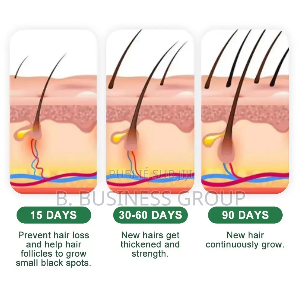 Crème Crowth Pour Cheveux À L’Alopécie