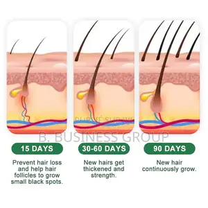 Crème Crowth Pour Cheveux À L’Alopécie