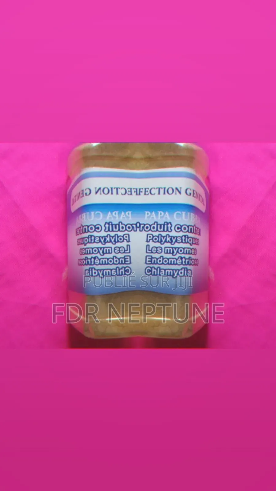 Infections Génitales