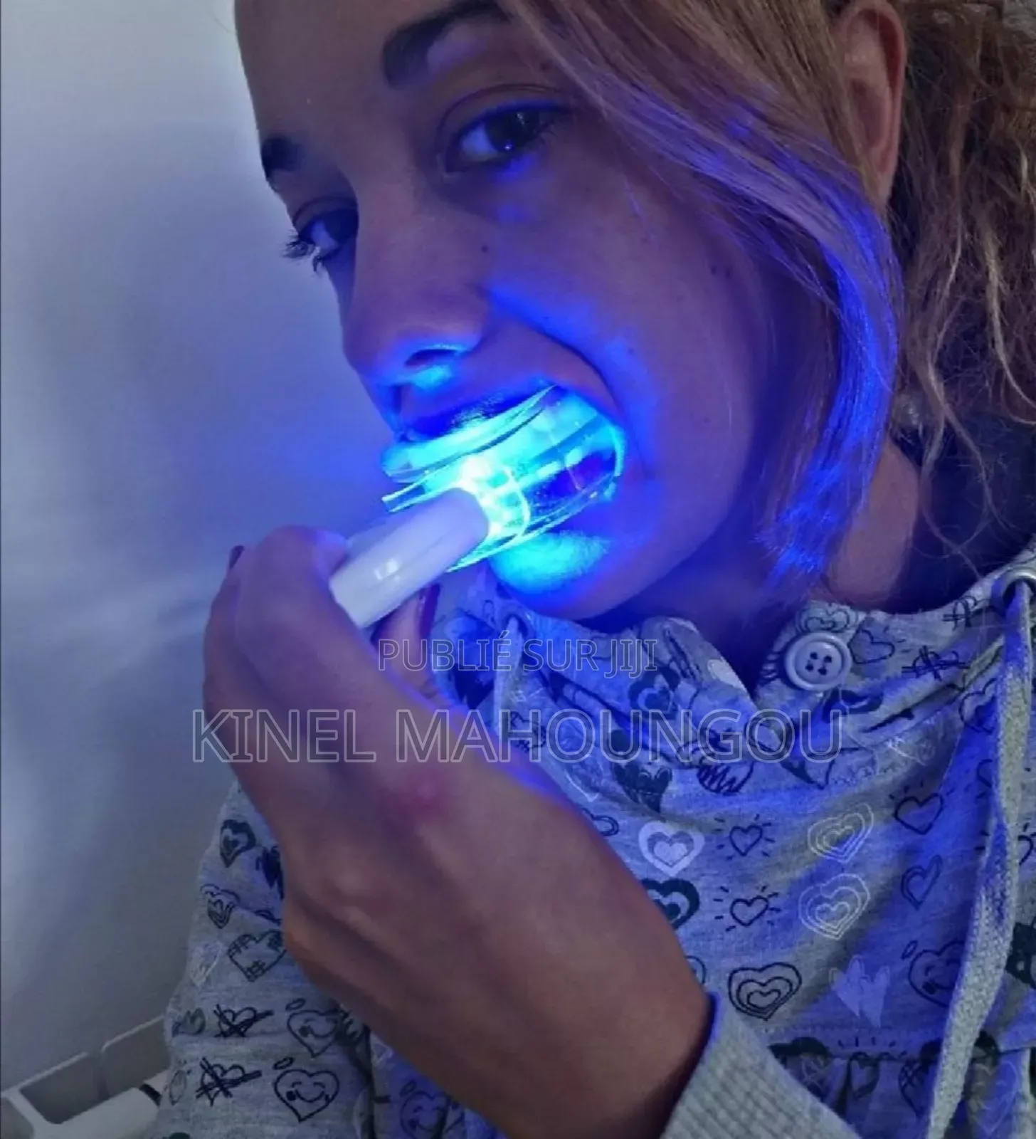 Blanchiment Dentaire