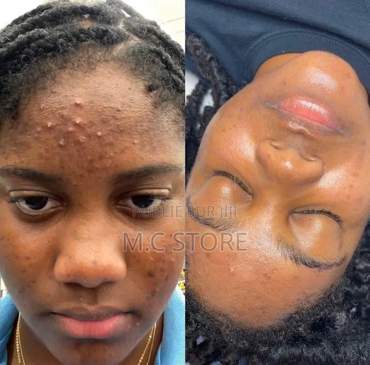 Déodorant Pour Homme