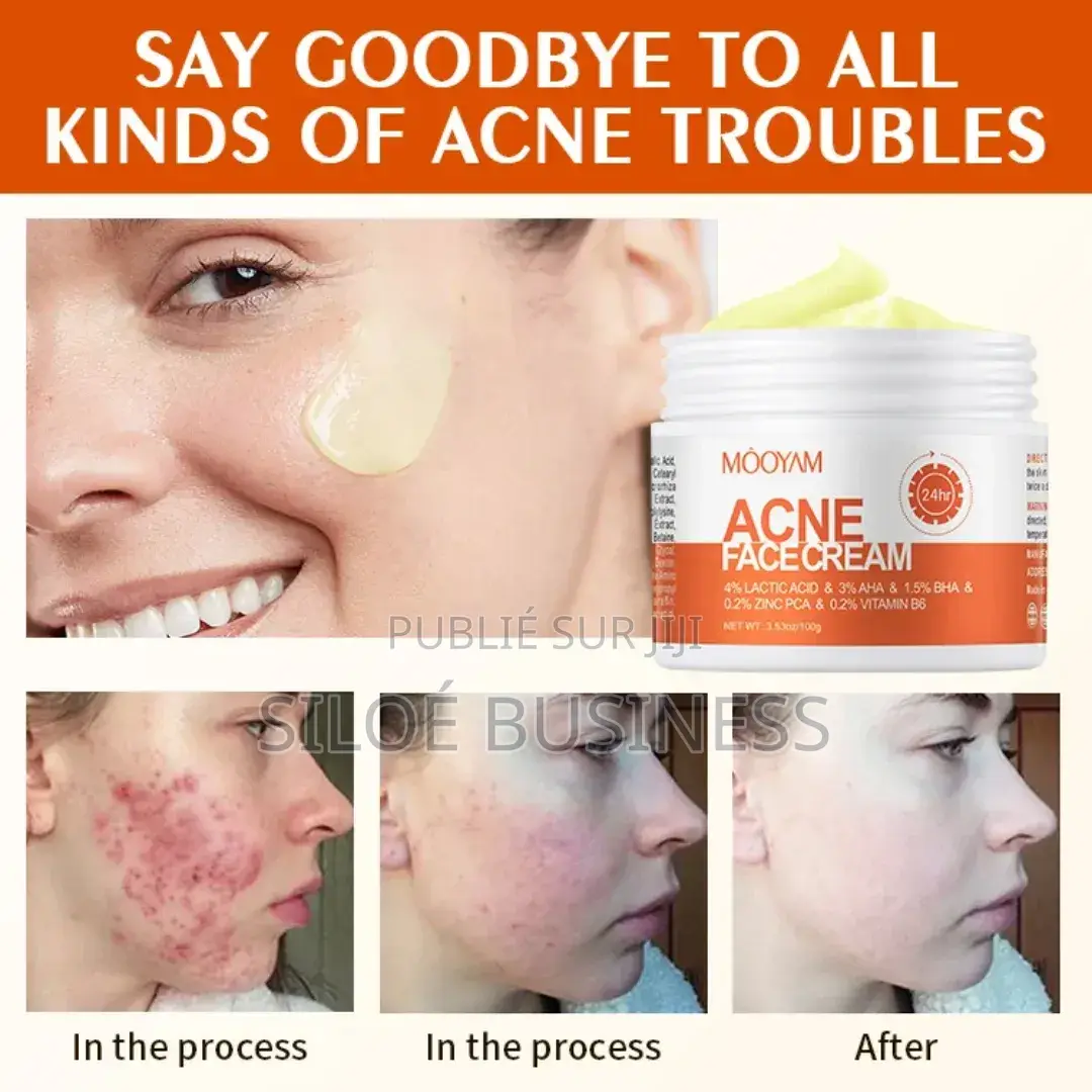 Crème Du Visage Mooyam Acné