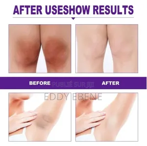 Blanchissant Les Parties Privées Et Supprime La Mélanine "Crème"