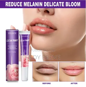 Blanchissant Les Parties Privées Et Supprime La Mélanine "Crème"