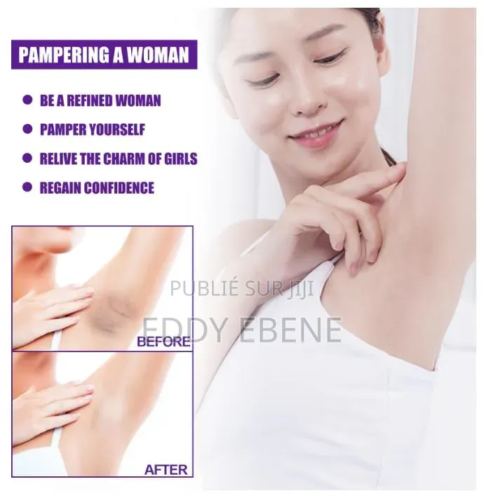 Blanchissant Les Parties Privées Et Supprime La Mélanine "Crème"