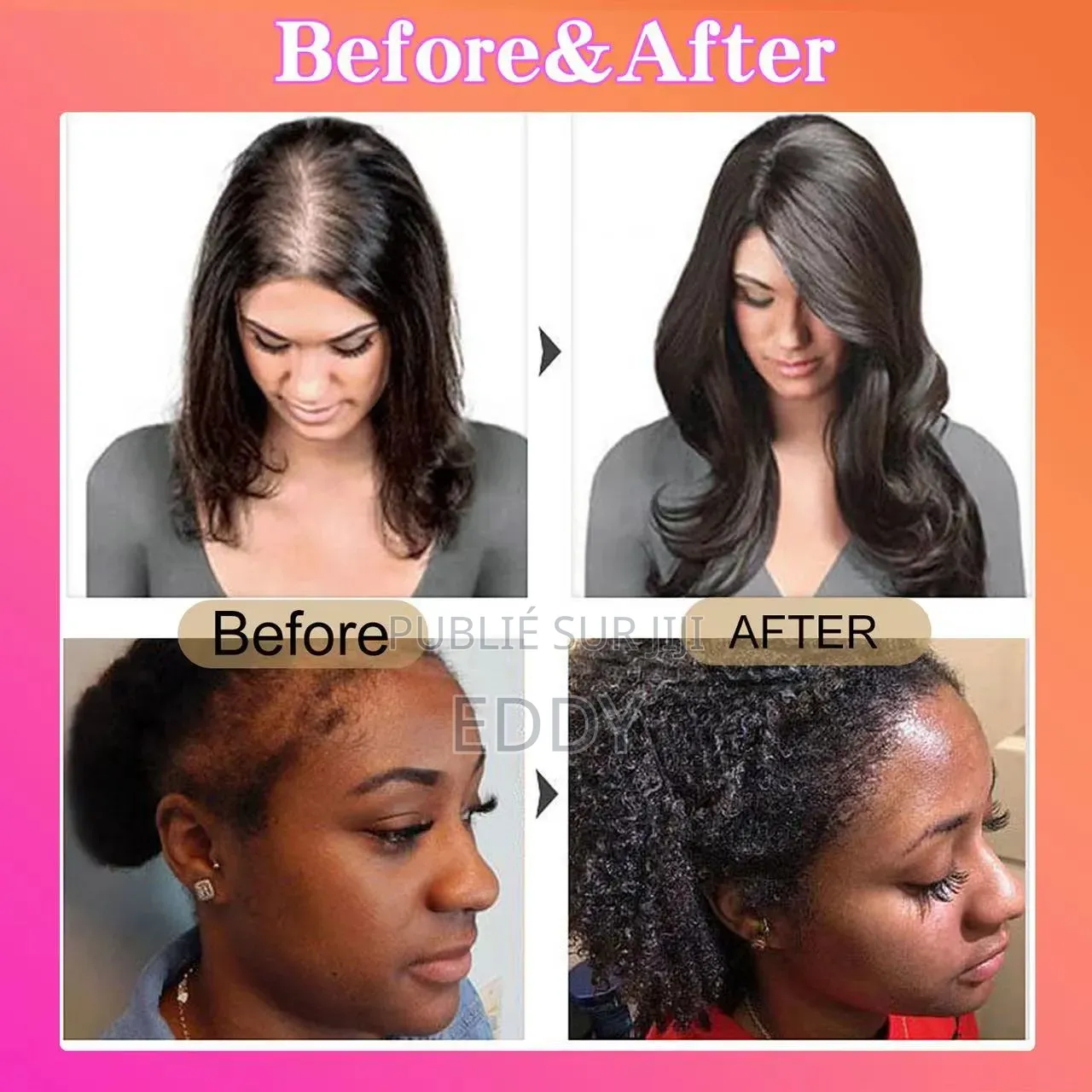 Huile Pour La Croissance Des Cheveux