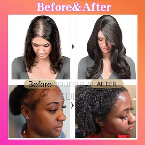 Huile Pour La Croissance Des Cheveux