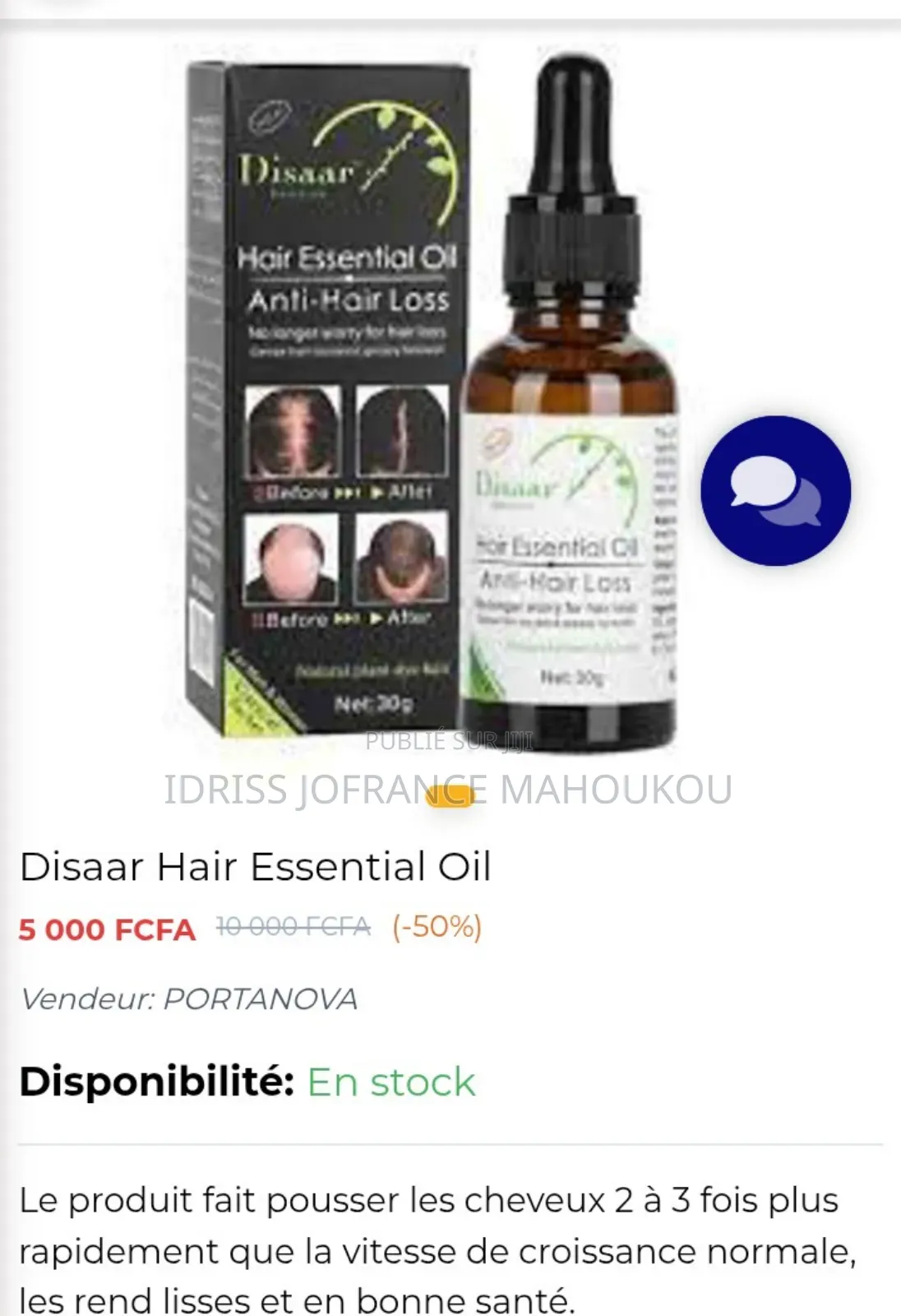 Huile Contre L'alopécie, La Calvitie, Chute De Cheveux