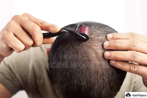 Derma Roller