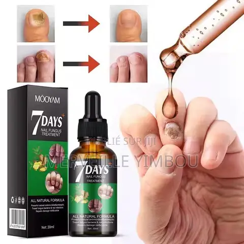 Traitement Ongle