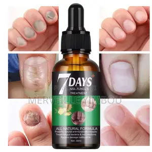 Traitement Ongle