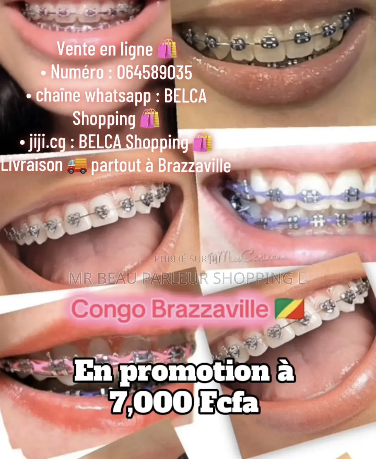 Appareils Dentaire